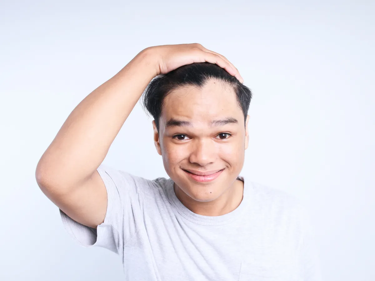 A young Filipino man in a light gray shirt smiling while inspecting his hairline with one hand on his head, symbolizing early signs of hair loss and self-awareness of male pattern baldness.